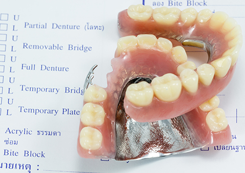 what-did-dentures-look-like_40090144.jpg