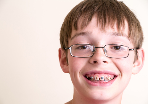 early-orthodontics_24813960.jpg