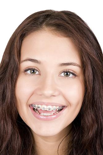 ortho-braces-teensmiling.jpg